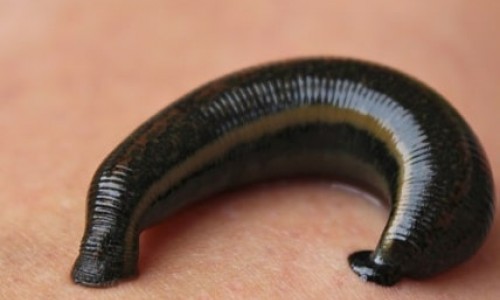 Medicinal Leech